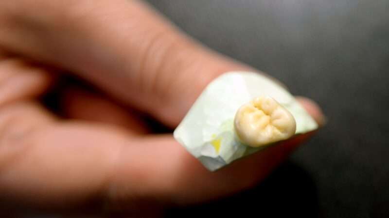 Co dělat když vypadne korunka nebo se zlomí?