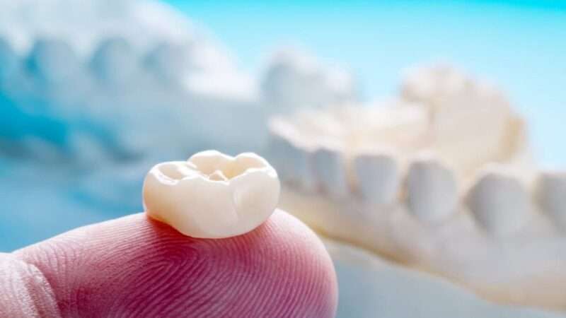 Když vypadne plomba – Jak dlouho může být zub bez plomby?